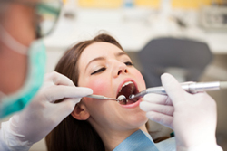 Oral Surgery | My Dentist | Alex Klim DDS | West Sacramento, CA